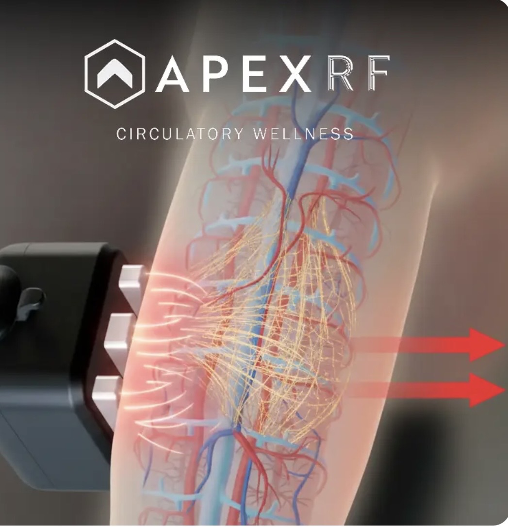 APEX RF illustration showing targeted treatment near local blood vessels